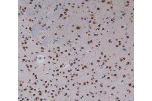 IHC-P analysis of Mouse Brain Tissue, with DAB staining. (KHDRBS1 antibody  (AA 156-381))