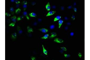 Immunofluorescence staining of Hela cells with ABIN7154715 at 1:167, counter-stained with DAPI. (GNAT2 antibody  (AA 2-139))