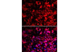 Immunofluorescence analysis of U2OS cells using QARS antibody (ABIN5974184).