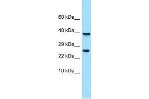 WB Suggested Anti-PDGFRL Antibody Titration: 1. (PDGFRL antibody  (N-Term))