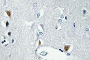 Immunohistochemistry (IHC) analyzes of p-Histone H2A. (H2AFX antibody  (pSer139))