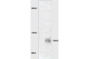Lane 1: mouse brain lysates Lane 2: mouse embryo lysates probed with Anti LRIG1 Polyclonal Antibody, Unconjugated (ABIN735263) at 1:200 in 4 °C. (Lrig1 antibody  (AA 1001-1093))
