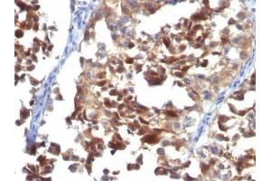 Image no. 2 for anti-CD63 (CD63) antibody (ABIN6187977) (CD63 antibody)