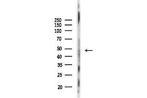 anti-Endothelin Receptor Type A (EDNRA) (C-Term) antibody