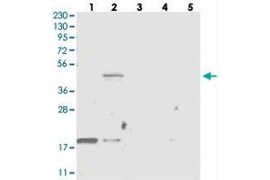 Western blot analysis of Lane 1: RT-4, Lane 2: U-251 MG, Lane 3: Human Plasma, Lane 4: Liver, Lane 5: Tonsil with THNSL2 polyclonal antibody . (THNSL2 antibody)