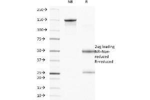 SDS-PAGE Analysis Purified CD104 Mouse Monoclonal Antibody (UMA9). (Integrin beta 4 antibody)