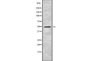 Western blot analysis of KCNJ8 using Jurkat whole cell lysates (KCNJ8 antibody)