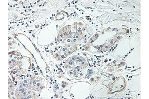 Image no. 4 for anti-Intercellular Adhesion Molecule 1 (ICAM1) antibody (ABIN465661) (ICAM1 antibody)