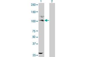 Western Blot analysis of KIT expression in transfected 293T cell line by KIT monoclonal antibody (M09), clone 1D3. (KIT antibody  (AA 41-140))