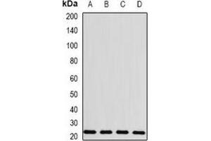 Western blot analysis of BLVRB expression in MCF7 (A), HepG2 (B), mouse spleen (C), rat liver (D) whole cell lysates. (BLVRB antibody)