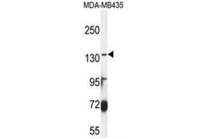 ABCC3 Antibody (Center) western blot analysis in MDA-MB435 cell line lysates (35 µg/lane). (ABCC3 antibody  (Middle Region))