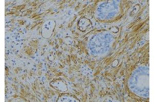 ABIN6274689 at 1/100 staining Human uterus tissue by IHC-P. (Laminin beta 1 antibody  (C-Term))