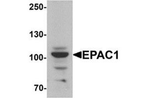 Western blot analysis of EPAC1 in rat skeletal muscle tissue lysate with EPAC1 Antibody  at 1 µg/ml.