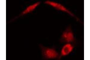 Immunofluorescence (fixed cells) (IF/ICC) image for anti-Aldolase A, Fructose-Bisphosphate (ALDOA) (N-Term) antibody (ABIN6257931)