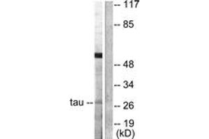 Western blot analysis of extracts from HeLa cells, using 14-3-3 thet/tau (Ab-232) Antibody. (14-3-3 theta antibody  (AA 196-245))