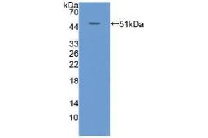 Western blot analysis of recombinant Human KRT20. (KRT20 antibody  (AA 9-424))