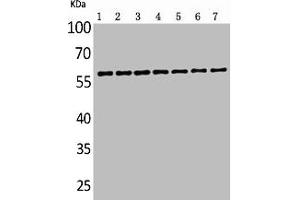 Western Blot analysis of customer's sample using ALPP/ALPPL2 Polyclonal Antibody. (PLAP antibody  (N-Term))