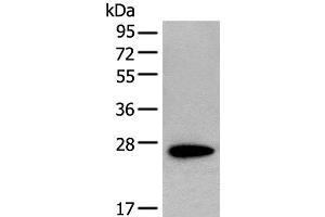 Western blot analysis of NIH/3T3 cell lysate using CD63 Polyclonal Antibody at dilution of 1:250 (CD63 antibody)