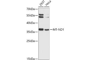 Western blot analysis of extracts of various cell lines, using MT-ND1 antibody (ABIN1680918, ABIN3019409, ABIN3019410 and ABIN6220887) at 1:1000 dilution. (MT-ND1 antibody  (AA 1-100))