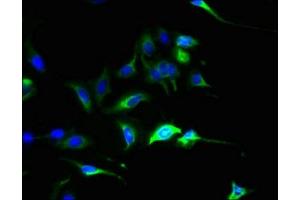 SLC44A4 antibody  (AA 56-229)