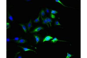 Immunofluorescent analysis of Hela cells using ABIN7147624 at dilution of 1:100 and Alexa Fluor 488-congugated AffiniPure Goat Anti-Rabbit IgG(H+L) (SLC44A4 antibody  (AA 56-229))