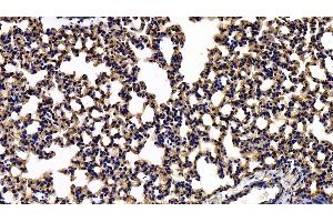 Immunohistochemistry (IHC) image for anti-Caveolin 1, Caveolae Protein, 22kDa (CAV1) (AA 2-104) antibody (ABIN7431323)