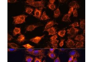 Immunofluorescence analysis of C6 cells using PTCD1 Polyclonal Antibody at dilution of 1:100. (PTCD1 antibody)