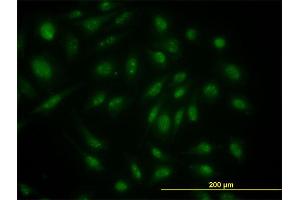 Immunofluorescence of monoclonal antibody to SKP1A on HeLa cell.