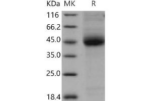 CD1d Protein (His tag)