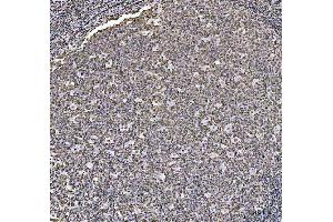 IHC analysis of HOXC4 using anti-HOXC4 antibody (ABIN7603059). (HOXC4 antibody  (Middle Region))