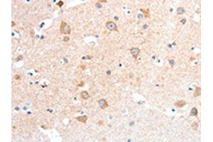 The image on the left is immunohistochemistry of paraffin-embedded Human brain tissue using ABIN7128440(ANXA8 Antibody) at dilution 1/25, on the right is treated with fusion protein. (Annexin VIII antibody)