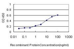 Detection limit for recombinant GST tagged TAF1A is approximately 0. (TAF1A antibody  (AA 1-100))