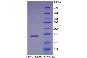 SDS-PAGE (SDS) image for Retinol Binding Protein 1, Cellular (RBP1) (AA 2-135) protein (His tag) (ABIN1980732) (RBP1 Protein (AA 2-135) (His tag))
