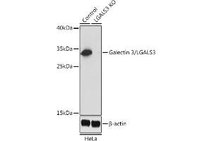 Western blot analysis of extracts from normal (control) and Galectin 3/Galectin 3/LG knockout (KO) HeLa cells, using Galectin 3/Galectin 3/LG antibody (ABIN6130437, ABIN6143158, ABIN6143159 and ABIN7101422) at 1:1000 dilution. (Galectin 3 antibody  (AA 1-250))