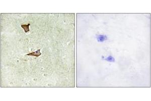 Immunohistochemistry analysis of paraffin-embedded human brain, using IGF2R (Phospho-Ser2409) Antibody. (IGF2R antibody  (pSer2409))