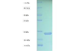 Von Willebrand Factor A Domain Containing 5B2 (VWA5B2) (AA 781-862), (partial) protein (His-SUMO Tag)