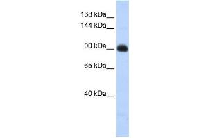 Matrilin 2 antibody used at 1 ug/ml to detect target protein. (MATN2 antibody  (Middle Region))