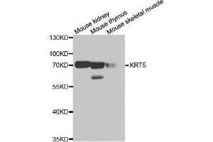 Western blot analysis of extracts of various cell lines, using KRT5 antibody. (Cytokeratin 5 antibody)