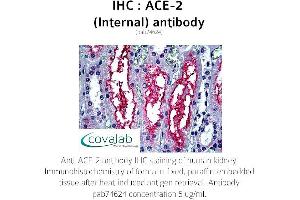 Image no. 2 for anti-Angiotensin I Converting Enzyme 2 (ACE2) (Internal Region) antibody (ABIN5693460) (ACE2 antibody  (Internal Region))