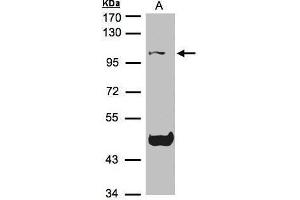 WB Image Sample(30 μg of whole cell lysate) A:Raji, 7. (NLRP3 antibody  (C-Term))