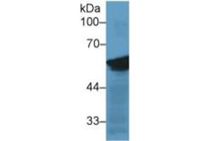 Mouse Capture antibody from the kit in WB with Positive Control: Sample Human Hela cell lysate. (Vimentin ELISA Kit)