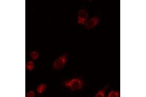 ABIN6276667 staining HeLa by IF/ICC. (FCGR2A antibody  (C-Term))