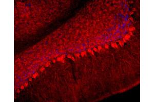 Immunohistochemistry (IHC) image for anti-Neurofilament, Light Polypeptide (NEFL) (AA 1-284) antibody (ABIN1742359) (NEFL antibody  (AA 1-284))