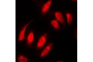 Immunofluorescent analysis of Topoisomerase 2 alpha staining in MDAMB231 cells. (Topoisomerase II alpha antibody  (N-Term))