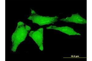 Immunofluorescence of monoclonal antibody to YBX1 on HeLa cell. (YBX1 antibody  (AA 51-139))