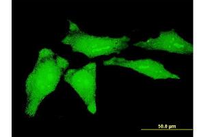 Immunofluorescence of monoclonal antibody to YBX1 on HeLa cell.