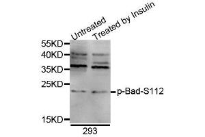 Western blot analysis of extracts of 293 cell line, using Phospho-Bad-S112 antibody (ABIN5969873). (BAD antibody  (pSer75))