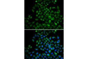 Immunofluorescence analysis of A549 cell using FABP4 antibody. (FABP4 antibody  (AA 1-132))