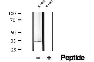 Western blot analysis of extracts of K-562 cells, using PDHB antibody. (PDHB antibody  (N-Term))