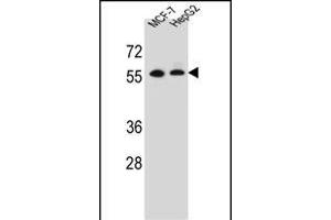 MGAT2 Antibody  (ABIN389038 and ABIN2839252) western blot analysis in MCF-7? (MGAT2 antibody  (C-Term))